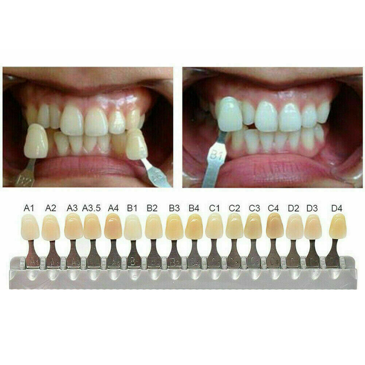 Vita Classical Shade Guide - Image 4